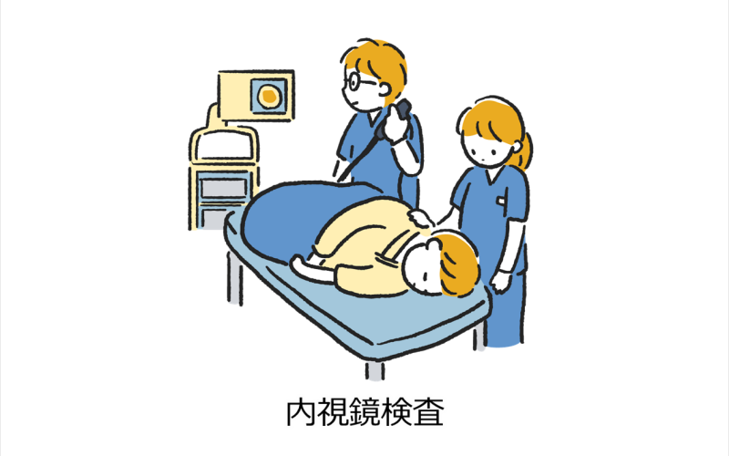 内視鏡検査